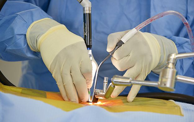 An In-Depth Summary of Endoscopic Spine Surgery
